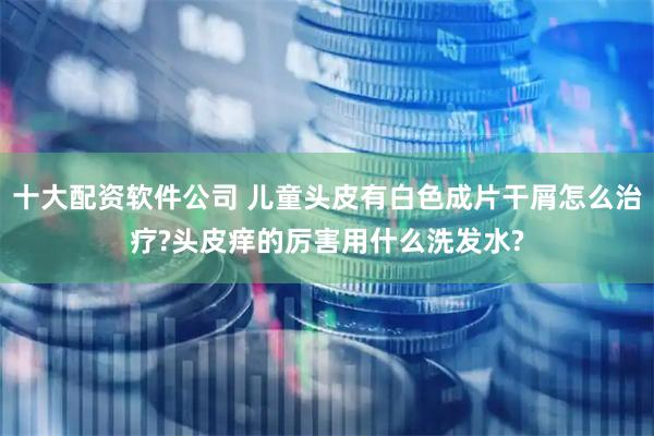 十大配资软件公司 儿童头皮有白色成片干屑怎么治疗?头皮痒的厉害用什么洗发水?